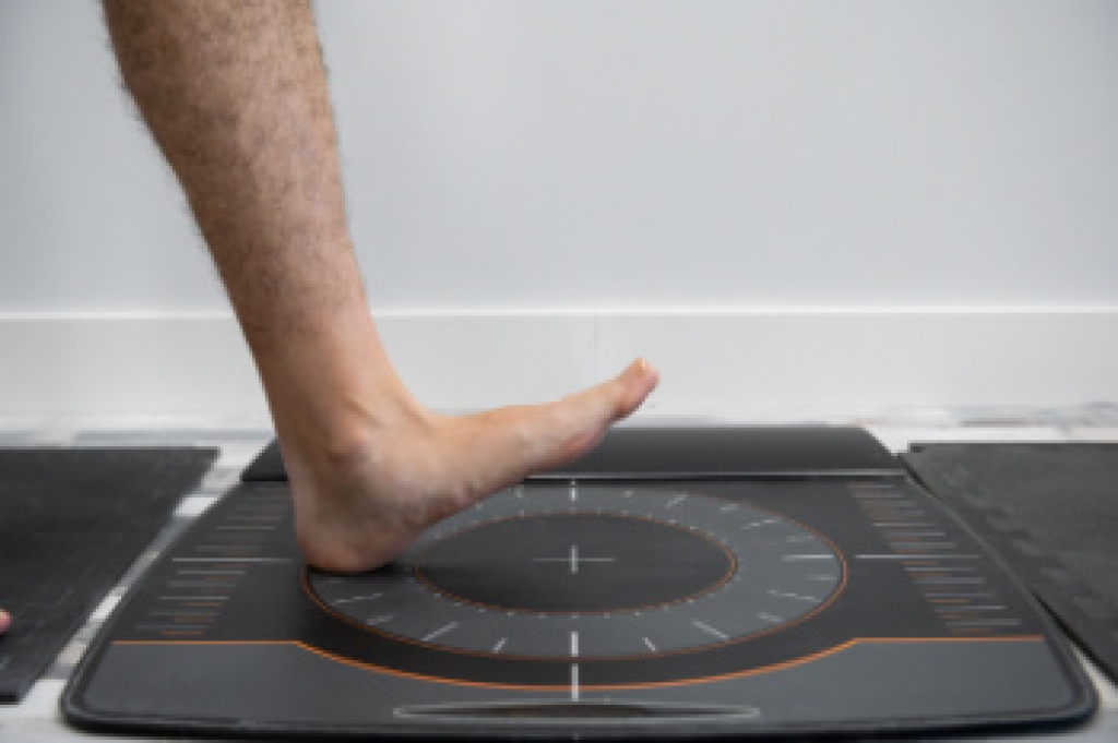 Improving Foot Pronation with Gait Retraining
