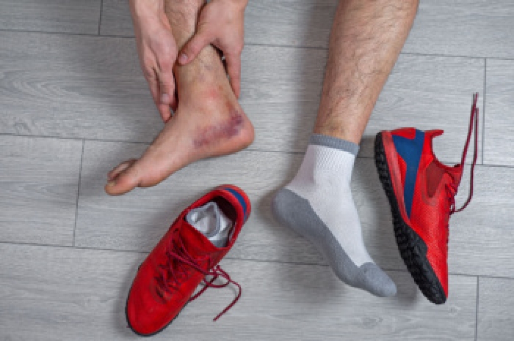 Causes, Symptoms, and Types of Ankle Sprains